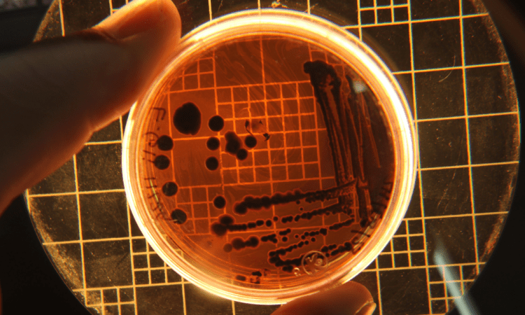cultivo bacterias